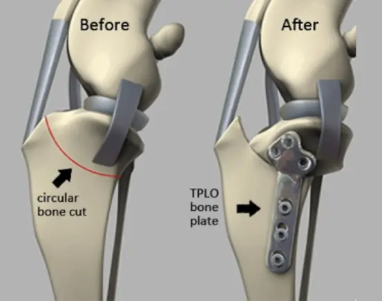 animated description off what tplo before and after is